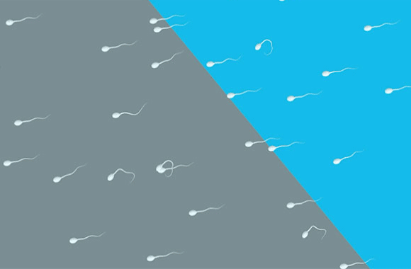 Why does sperm health matter.
